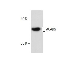 ACADS Antibody (G-10): sc-365953
