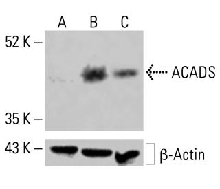 ACADS Antibody (G-10) - Western Blotting - Image 414422 