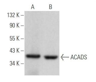ACADS Antibody (G-10) - Western Blotting - Image 366035
