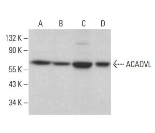 ACADVL Antibody (D-11) - Western Blotting - Image 385262 