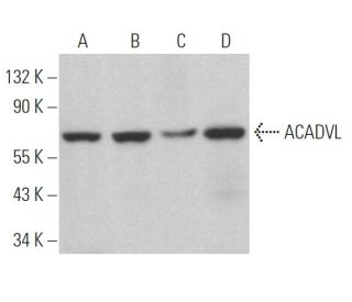 ACADVL Antibody (H-7) - Western Blotting - Image 364157