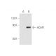 ACAP1 Antibody (G-4) - Western Blotting - Image 59195