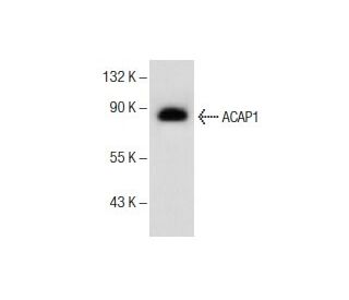 ACAP1 Antibody (B-11) - Western Blotting - Image 156441SAM Transcription Activation: SAM system utilizing dCas9-VP64, MS2-P65-HSF1, and sgRNA for precise gene transcription activation. 