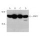 ACAT-1 Antibody (AT15E5) - Western Blotting - Image 384043