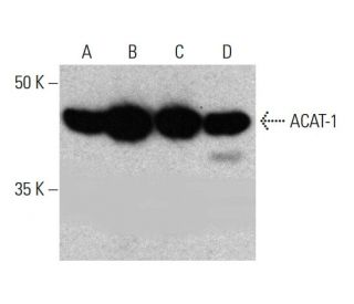 ACAT-1 Antibody (AT15E5) - Western Blotting - Image 384043SAM Transcription Activation: SAM system utilizing dCas9-VP64, MS2-P65-HSF1, and sgRNA for precise gene transcription activation. 
