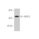 ACAT-2 Antibody (4A5) - Western Blotting - Image 347643