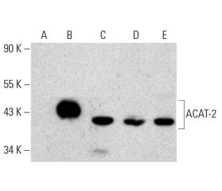 ACAT-2 Antibody (4A5) - Western Blotting - Image 384041 