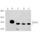 ACAT-2 Antibody (4A5) - Western Blotting - Image 384041 