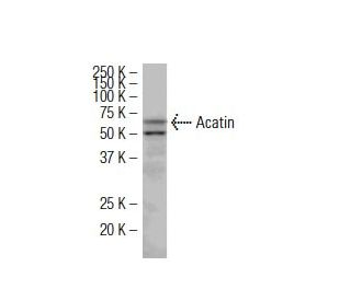 Acatin Antibody (36-X) - Western Blotting - Image 34662