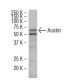 Acatin Antibody (36-X) - Western Blotting - Image 34662