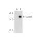 ACBD4 Antibody (G-8) - Western Blotting - Image 326499