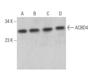 ACBD4 Antibody (G-8) - Western Blotting - Image 372053 