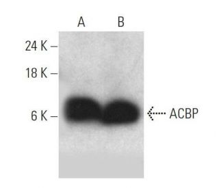 ACBP Antibody (C-9) - Western Blotting - Image 358578 