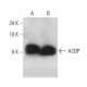 western blotting image from recommended ACBP (C-9) monoclonal antibody replacement. Image 358578