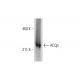 ACCβ Antibody (A-10) - Western Blotting - Image 289465