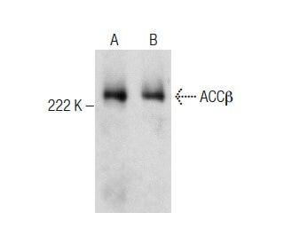 ACC&beta; Antibody (F-9) - Western Blotting - Image 283463