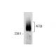 ACCβ Antibody (H-7) - Western Blotting - Image 287853 