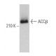 ACCβ Antibody (H-7) - Western Blotting - Image 373382 