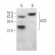 ACD Antibody (A-8) - Western Blotting - Image 366374
