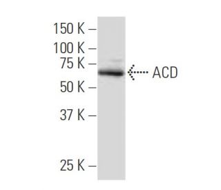 ACD Antibody (AA-2) - Western Blotting - Image 33967 
