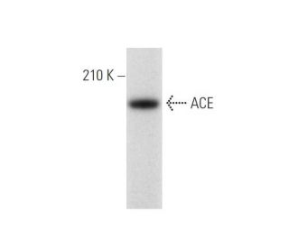 ACE Antibody (3H533) - Western Blotting - Image 137020