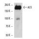 ACE Antibody (5C5) - Western Blotting - Image 3771