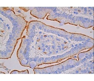 immunohistochemistry image from recommended ACE (2E2) monoclonal antibody replacement. Image 387524