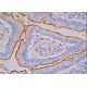 immunohistochemistry image from recommended ACE (2E2) monoclonal antibody replacement. Image 387524