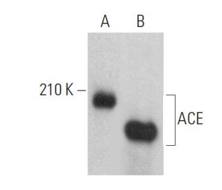 ACE Antibody (E-9) - Western Blotting - Image 379424 