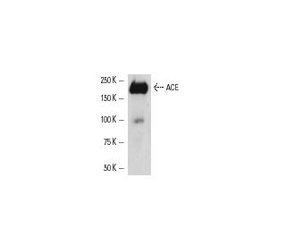 ACE Antibody (5C5) - Western Blotting - Image 3771