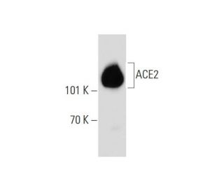 ACE2 Antibody (AC18Z) - Western Blotting - Image 147494