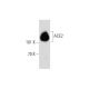 ACE2 Antibody (AC18Z) - Western Blotting - Image 147494