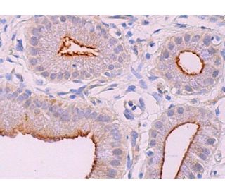 immunohistochemistry image from recommended ACE2 (E-11) monoclonal antibody replacement. Image 370262