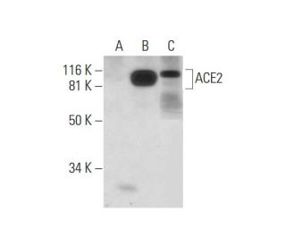ACE2 Antibody (E-11) - Western Blotting - Image 290838The Double Nickase Plasmid features a U6 promoter for sgRNA expression, a 20 nt targeting sequence, and a gRNA scaffold to guide Cas9n. It includes a CBh promoter for Cas9n (D10A) and puromycin resistance, GFP for transfection verification, and nuclear localization signals (NLS). The 2A peptide allows co-expression of Cas9n and Puro from a single promoter, enabling precise genome editing with reduced off-target effects.