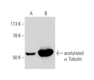 acetylated alpha Tubulin Antibody 6 11B 1 SCBT Santa Cruz