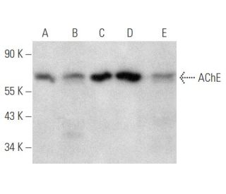western blotting image from recommended AChE (A-11) monoclonal antibody replacement. Image 354798