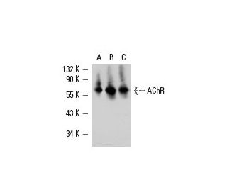 Nicotinic Acetylcholine Receptor alpha/CHRNA Antibody (G10) - Western Blotting - Image 11697