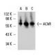 Nicotinic Acetylcholine Receptor alpha/CHRNA Antibody (G10) - Western Blotting - Image 11697
