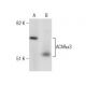 Nicotinic Acetylcholine Receptor alpha 3/CHRNA3 Antibody (313) - Western Blotting - Image 260748