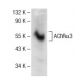 Nicotinic Acetylcholine Receptor alpha 3/CHRNA3 Antibody (C-6) - Western Blotting - Image 141566