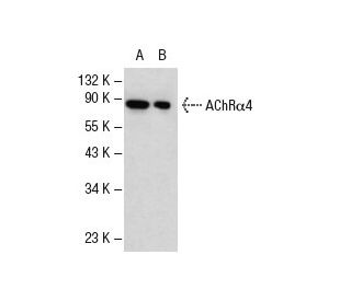 western blotting image from recommended Nicotinic Acetylcholine Receptor alpha 4/CHRNA4 (A-6) monoclonal antibody replacement. Image 17718