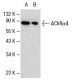 This polyclonal antibody has been discontinued. See our recommended <a href="achralpha4-antibody-a-6">Nicotinic Acetylcholine Receptor alpha 4/CHRNA4 (A-6)</a> monoclonal antibody (sample data shown). western blotting image from recommended Nicotinic Acetylcholine Receptor alpha 4/CHRNA4 (A-6) monoclonal antibody replacement. Image 17718