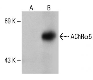 Nicotinic Acetylcholine Receptor alpha 5/CHRNA5 Antibody (268) - Western Blotting - Image 109795 