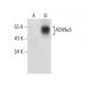 Nicotinic Acetylcholine Receptor alpha 5/CHRNA5 Antibody (D-11) - Western Blotting - Image 164537