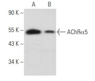 Nicotinic Acetylcholine Receptor alpha 5/CHRNA5 Antibody (D-11) - Western Blotting - Image 356883 