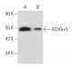 Nicotinic Acetylcholine Receptor alpha 5/CHRNA5 Antibody (D-11) - Western Blotting - Image 356883 