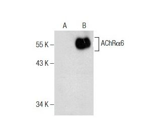 Nicotinic Acetylcholine Receptor alpha 6/CHRNA6 Antibody (G-4) - Western Blotting - Image 160764