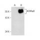 Nicotinic Acetylcholine Receptor alpha 6/CHRNA6 Antibody (G-4) - Western Blotting - Image 160764