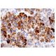Este anticuerpo policlonal ha dejado de fabricarse. Consulta nuestro anticuerpo monoclonal recomendado <a href="achralpha7-antibody-319">Nicotinic Acetylcholine Receptor alpha 7/CHRNA7 (319)</a> (se muestran datos de muestra). immunohistochemistry image from recommended Nicotinic Acetylcholine Receptor alpha 7/CHRNA7 (319) monoclonal antibody replacement. Image 157171