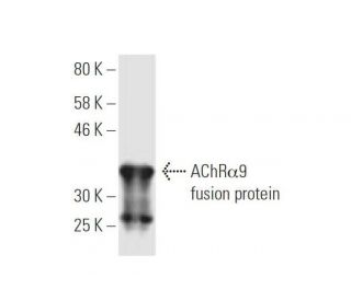 Nicotinic Acetylcholine Receptor alpha 9/CHRNA9 Antibody (8E4) - Western Blotting - Image 350228